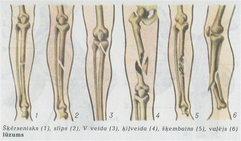 neslimo.lv